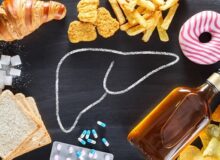 Ficat gras: cauze, simptome și tratamente eficiente