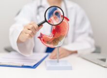Ulcer duodenal: ce este, simptome, cauze, tratament și regim alimentar
