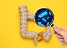 Disbioza intestinală: ce este, ce cauze are, cum se manifestă, care este alimentația corectă