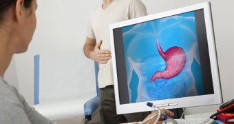 Cancerele cu localizare digestiva