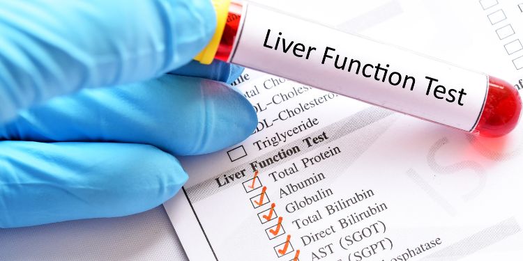 factori de risc pentru ciroza hepatica, ciroza hepatica cauze, ciroza hepatica simptome, stadii ciroza hepatica, ciroza hepatica diagnostic, analize de sange pentru ciroza hepatica,