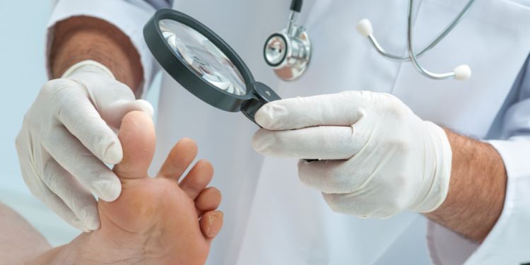 diagnostic ciuperca piciorului (tinea pedis),