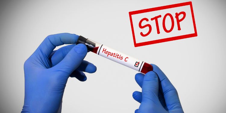 cum prevenim hepatita C, 