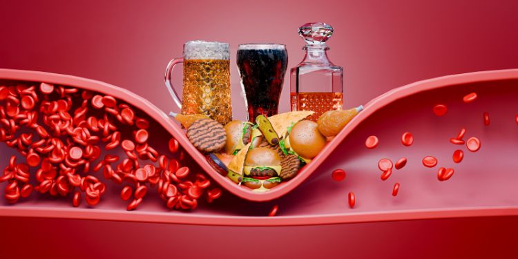 ce este hipercolesterolemia, de ce nu trebuie ignorata hipercolesterolemia, cauzele hipercolesterolemiei, hipercolesterolemia si alimentatia nesanatoasa, obezitatea si rezistenta la insulina in hipercolesterolemie, factori de risc pentru hipercolesterolemie, simptomele hipercolesterolemiei, hipercolesterolemie diagnostic si depistare, tratamentul hipercolesterolemiei, rolul dietei in hipercolesterolemie, alimente recomandate in hipercolesterolemie, alimente de evitat in hipercolesterolemie, complicatiile hipercolesterolemiei, preventia hipercolesterolemiei,