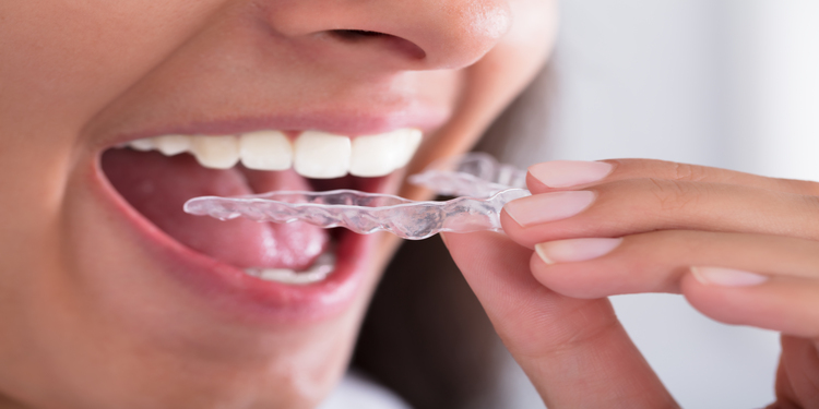 Scrasniti din dinți noaptea? Poate fi vorba de bruxism