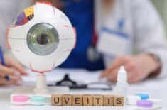 Uveita: semne și simptome. Complicații asociate. Tratament și prevenție