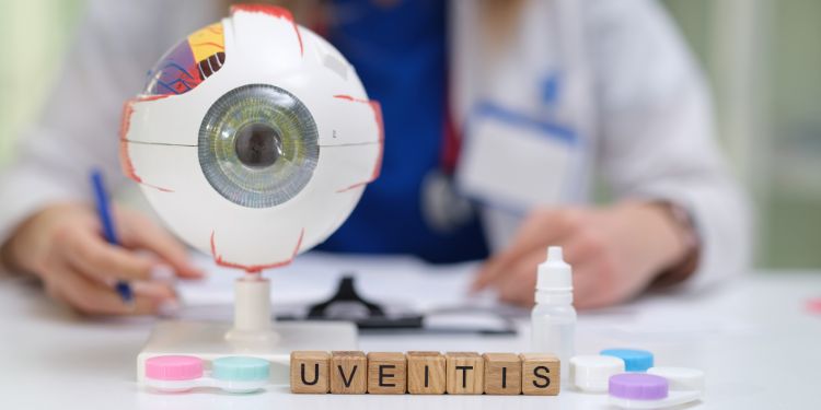 Uveita: semne și simptome. Complicații asociate. Tratament și prevenție
