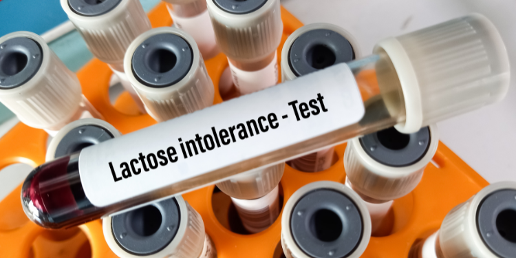 intoleranta la lactoza, simptome intoleranta, test intoleranta lactoza, tratament intoleranta, 