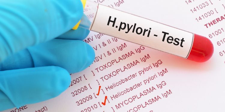 investigatii necesare gastrita acuta, endoscopie gastrita acuta, gastrita acuta Helicobacter pylori, complicatii gastrita acuta,
