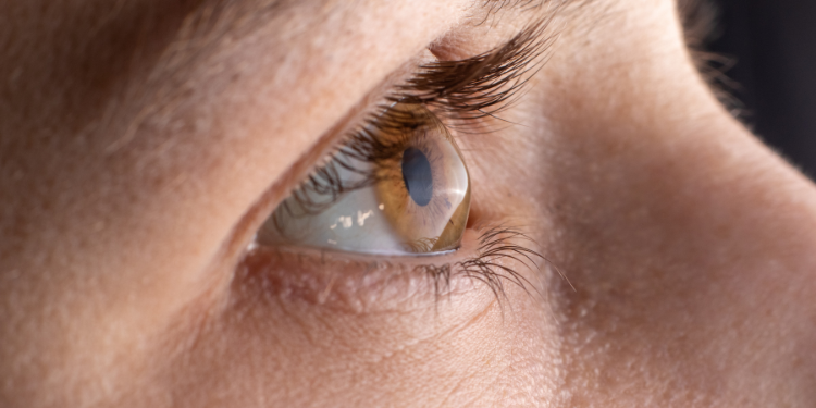 Keratoconus, de la diagnostic la tratament: tot ce trebuie să știți