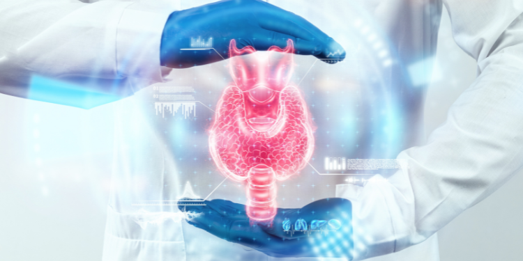 hipertiroidism, tiroida, hormoni tiroidieni, simptome hipertiroidism, tratament hipertiroidism, 