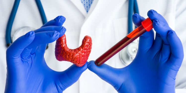 hipotiroidism cauze, hipotiroidism simptome, hipotiroidism tratament, hipotiroidism complicatii, hipotiroidism diagnostic, hipotiroidism analize necesare,