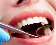 Dinti frumosi si sanatosi cu ajutorul tratamentelor ortodontice
