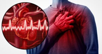 Infarct miocardic sau angină pectorală?