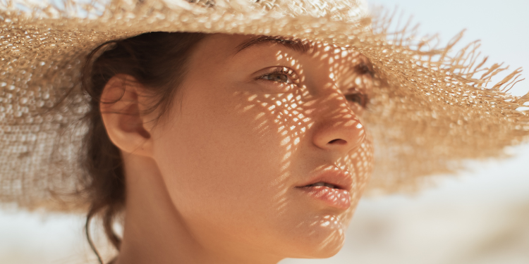pete pigmentare, hiperpigmentare, melasma, melanina, remedii pete pigmentare, tratament pete pigmentare, 