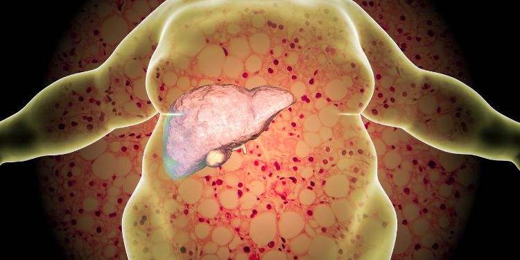 obiceiuri care distrug ficatul, ce rol are ficatul, cine imbolnavește ficatul, cum imbolnaveste obezitatea ficatul, cum afecteaza alcoolul ficatul, cum ajunge ficatul la fibroza si ciroza, hepatitele si imbolnavirea ficatului, cum afecteaza ficatul medicamentele si suplimentele, zaharul si produsele ultraprocesate imbolnavesc ficatul, semne care anunta probleme hepatice, cum poate fi protejat ficatul,