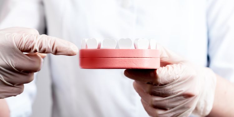 diagnosticul retractiei gingivale,