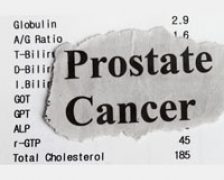Dispozitivul care ar putea reduce efectele secundare ale prostatectomiei