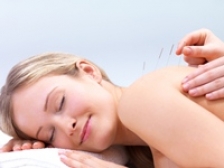 Acupunctura, remediu impotriva oboselii