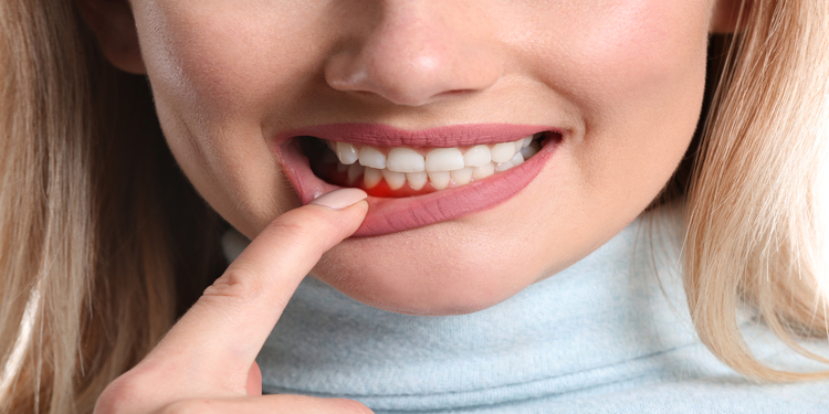 Tratament gingivită, simplu și eficient