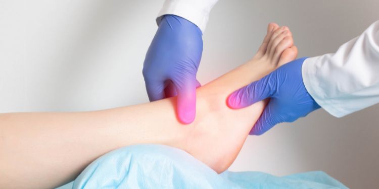 cand se merge la medic pentru entorsa de glezna, importanta mobilizarii treptate dupa entorsa de glezna, 