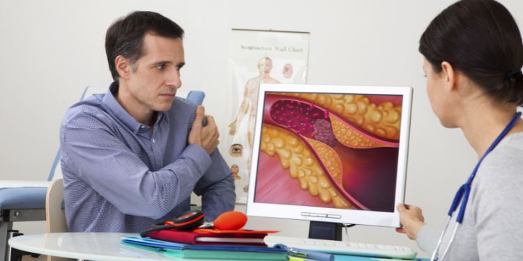Aterom (placa de aterom): cauze, evoluție și complicații