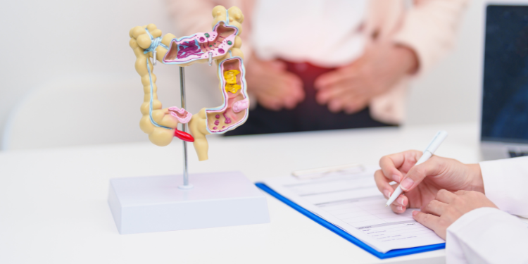 boala crohn, rectocolita ulcero-hemoragica, colita ulcerativa, cauze rectocolita ulcero-hemoragica, simptome rectocolita ulcero-hemoragica, diagnostic rectocolita ulcero-hemoragica, tratament rectocolita ulcero-hemoragica,