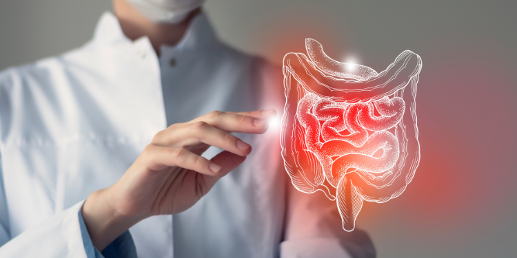 boala crohn, rectocolita ulcero-hemoragica, colita ulcerativa, cauze rectocolita ulcero-hemoragica, simptome rectocolita ulcero-hemoragica, diagnostic rectocolita ulcero-hemoragica, tratament rectocolita ulcero-hemoragica,