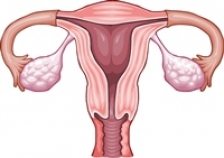 Cancerul ovarian – investigatii si tratament
