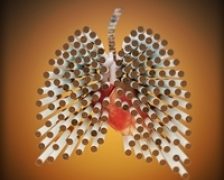 Diagnosticarea si tratamentul cancerului pulmonar