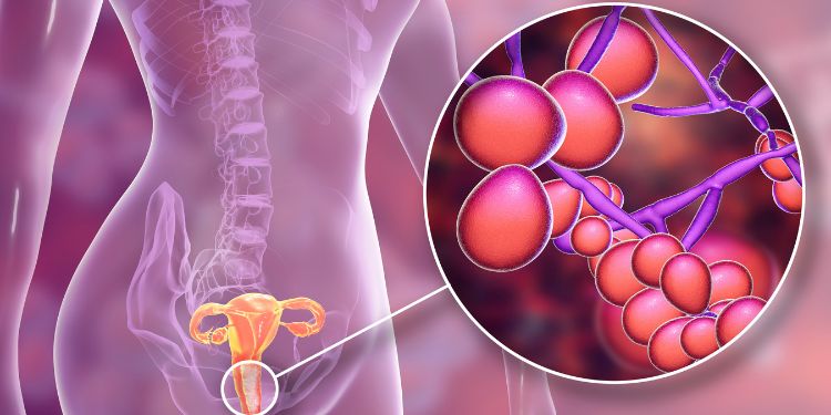 analize ginecologice pentru Candida albicans si Trichomonas vaginalis,