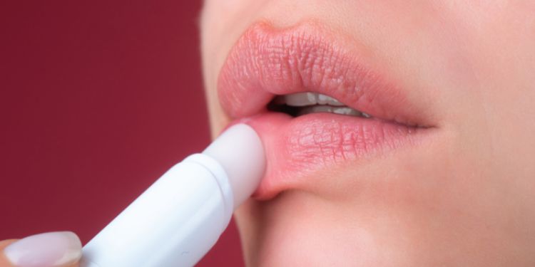 ce poti folosi pentru buze crapate, ce sa nu folosesti pentru buze crapate, remedii pentru buze crapate, tratament pentru buze crapate, buze crapate consultul medical, 