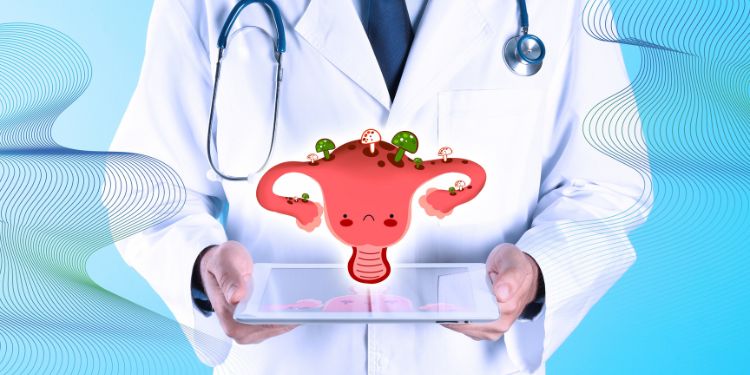 tratament candida vaginala, prevenire candida vaginala, trucuri pentru a preveni infecția cu candida, 