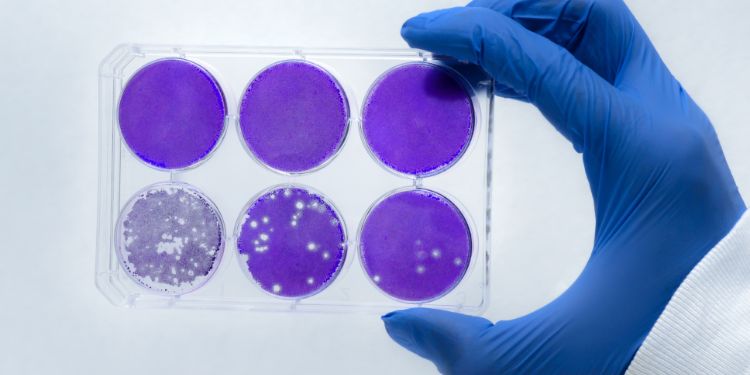 ce este ebola, cum se transmite ebola, diagnostic ebola, ebola tratament, cum putem preveni infectarea cu ebola, cat de periculoasa este ebola,
