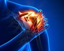 Plexul brahial: tipuri de leziuni si diagnosticul acestora
