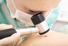 Aproape 3% dintre romanii testati gratuit prezinta risc de melanom malign