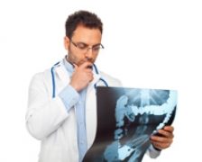 5 obiceiuri sanatoase care ajuta la prevenirea cancerului colorectal