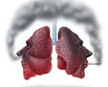 Cancerul pulmonar ar putea ramane in stand by chiar si 20 de ani