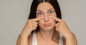 De ce apar cearcănele? 10 moduri prin care putem scăpa de cearcăne