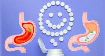 Medicamente antiacide. De câte tipuri sunt. Când se administrează. Precauții și reacții adverse