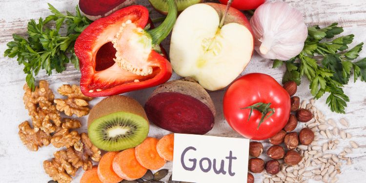 atacul de guta preventie, alimente guta,