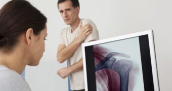 Osteoporoza la bărbați, tot ce trebuie să știți