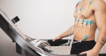 De ce trebuie realizat un test de efort EKG