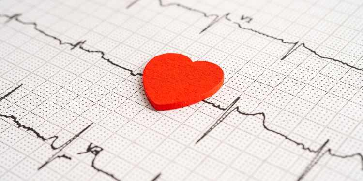 avantajele testului de efort EKG, testul de efort EKG limitari si contraindicatii, testul de efort EKG interpretarea rezultatelor, pregatirea pentru testul de efort EKG,