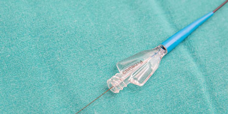 testul de efort EKG interpretarea rezultatelor, pregatirea pentru testul de efort EKG,