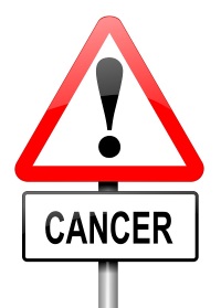 cancer-nazal-2