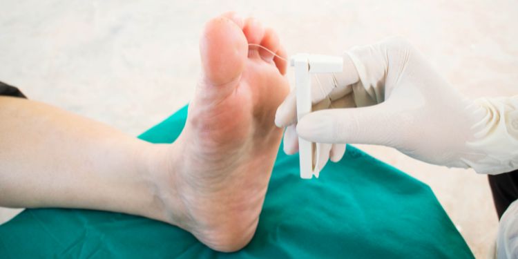 boala Charcot simptome, boala Charcot tratament, boala Charcot cauze, artropatia Charcot tratament,