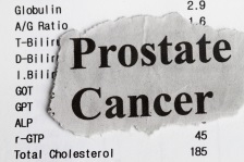 Cancerul de prostata: care sunt simptomele si cum este diagnosticat?