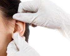 Otoplastia – ce este si ce efecte are asupra urechilor decalotate