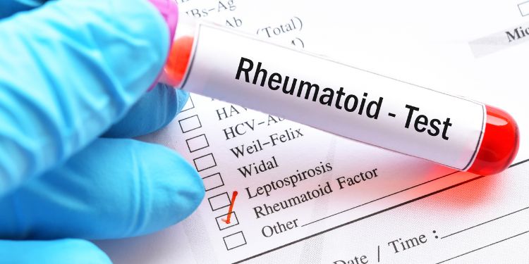 artrita reumatoida diagnostic